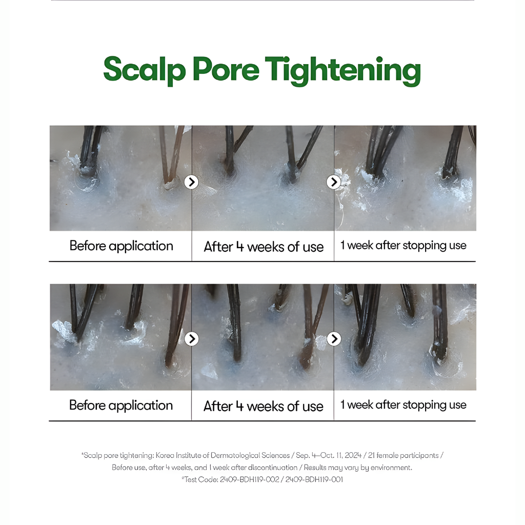 PDRN Reedle Shot For Hair