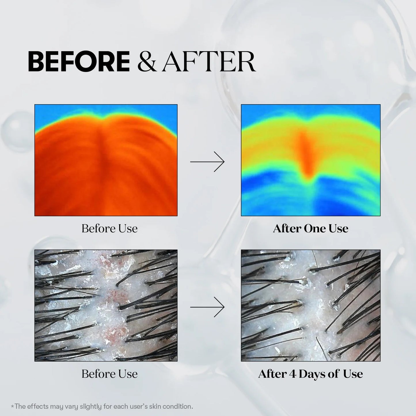 PDRN Reedle Shot For Hair